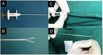 Laparoscopic vs. Open Repair Surgery for the Treatment of Communicating Hydrocele in Children: A Retrospective Study From a Single Center